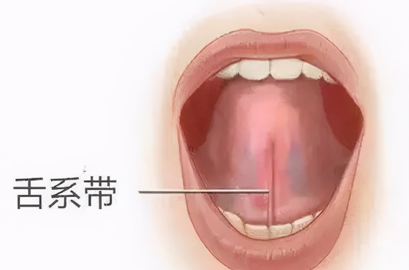 滥用的“剪舌系带”,舌系带到底该不该剪?这一刀孩子挨得很无辜