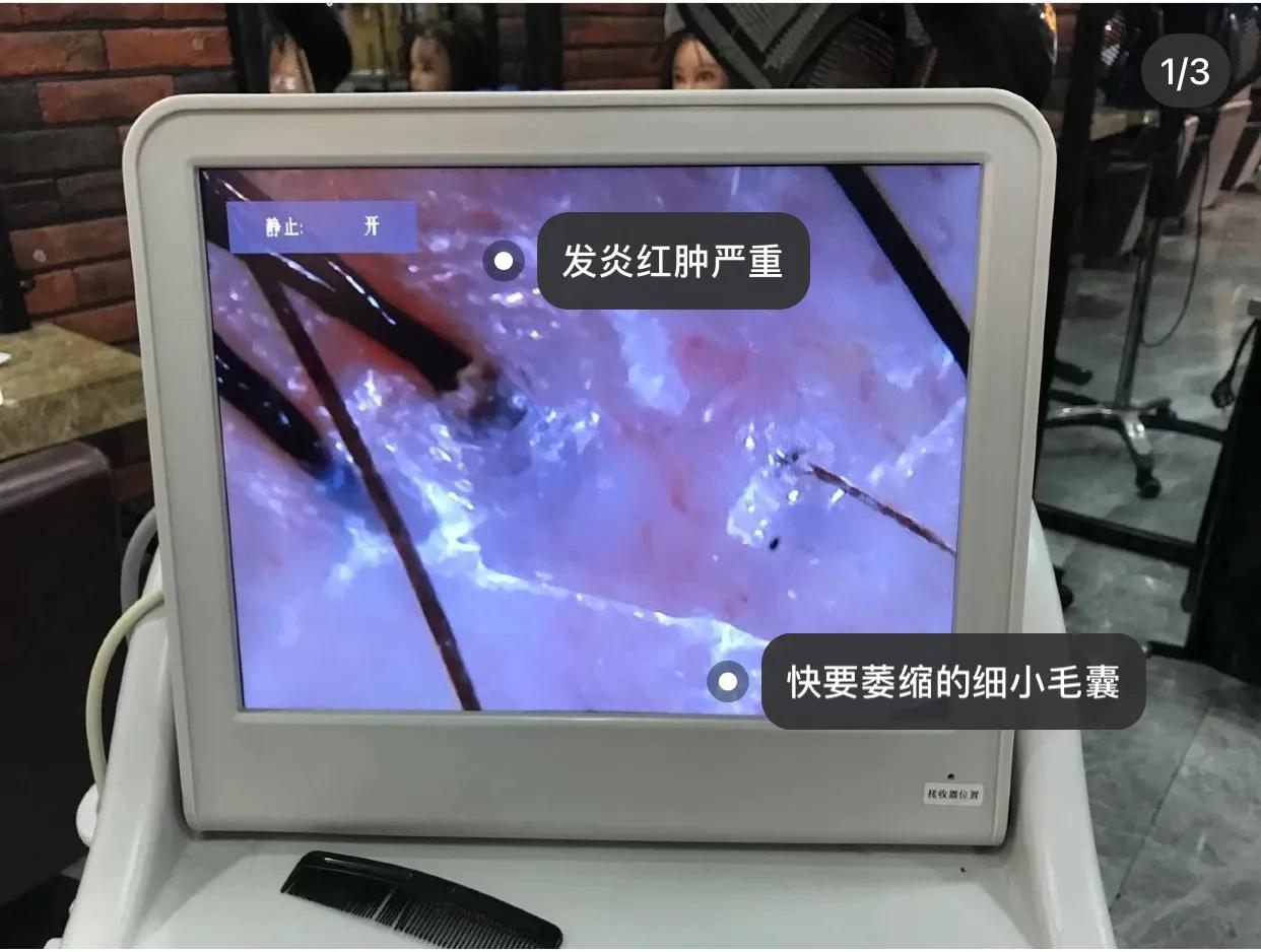 气血不足导致脱发？学会一种你就能成为发量王者