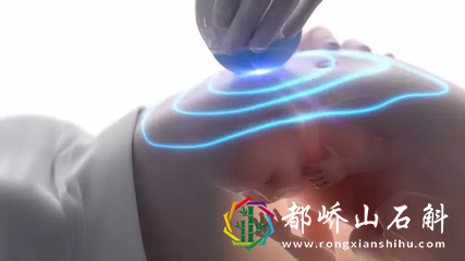 NT彩超上这几个数据，真的能看出是男宝宝还是女宝宝么？