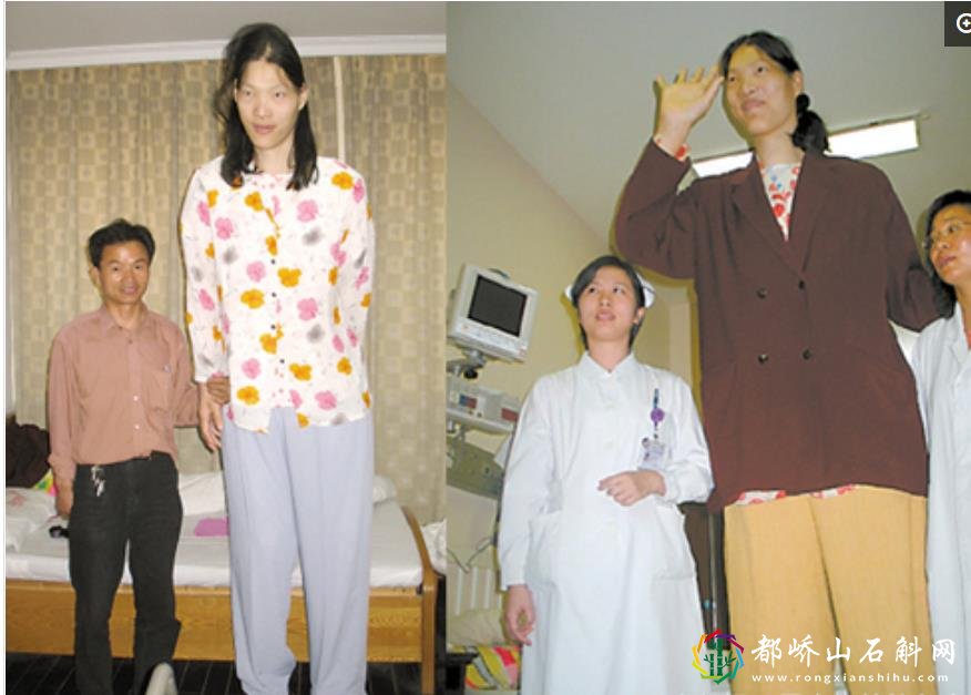 中国十大最高巨人,姚明竟然排不上榜