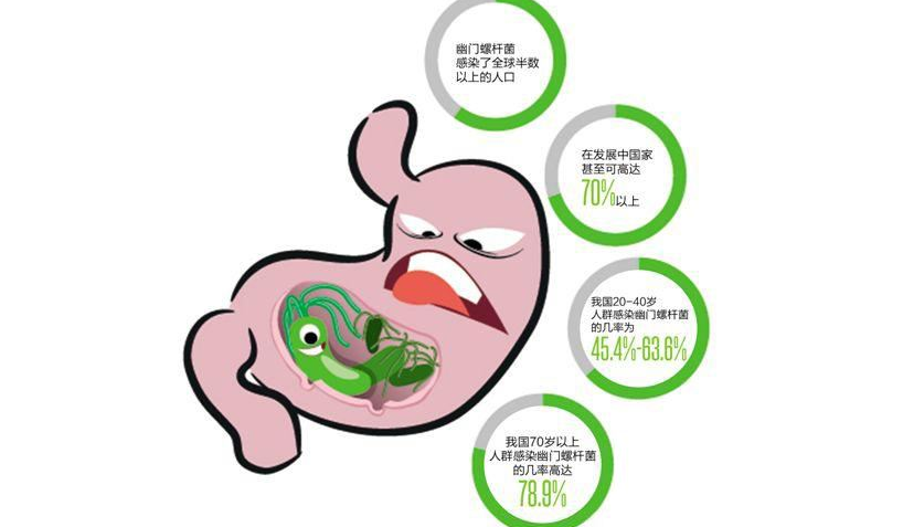 45岁女子感染幽门螺杆菌致胃癌(45岁女子感染幽门螺杆菌致)