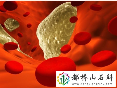 降脂药可以减肥吗【降脂药有减肥效果吗】