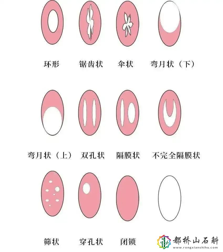 和男朋友第一次应该怎么做