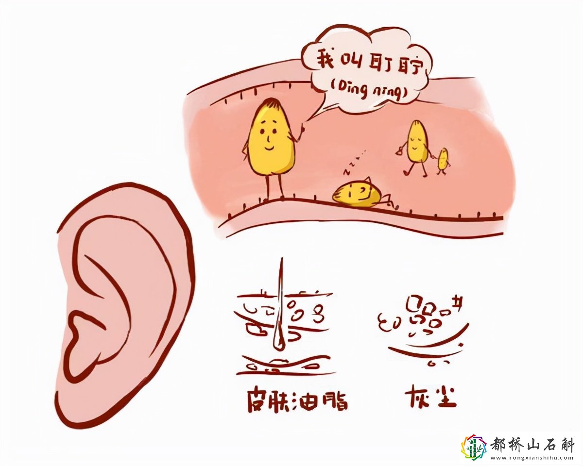 多久掏一次耳朵比较合理?
