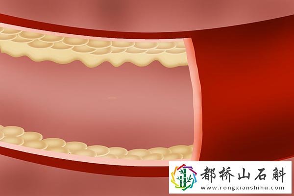 每天最多吃几个鸡蛋【一个人正常吃几个鸡蛋】