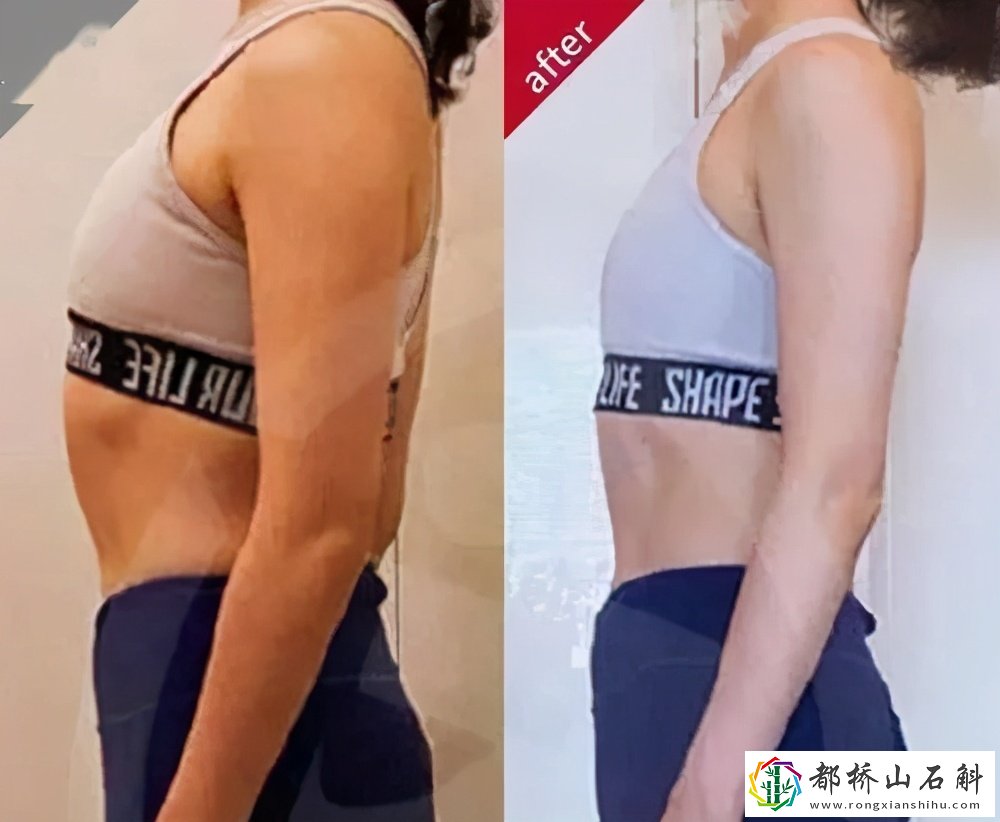 靠墙站立减肥多久见效