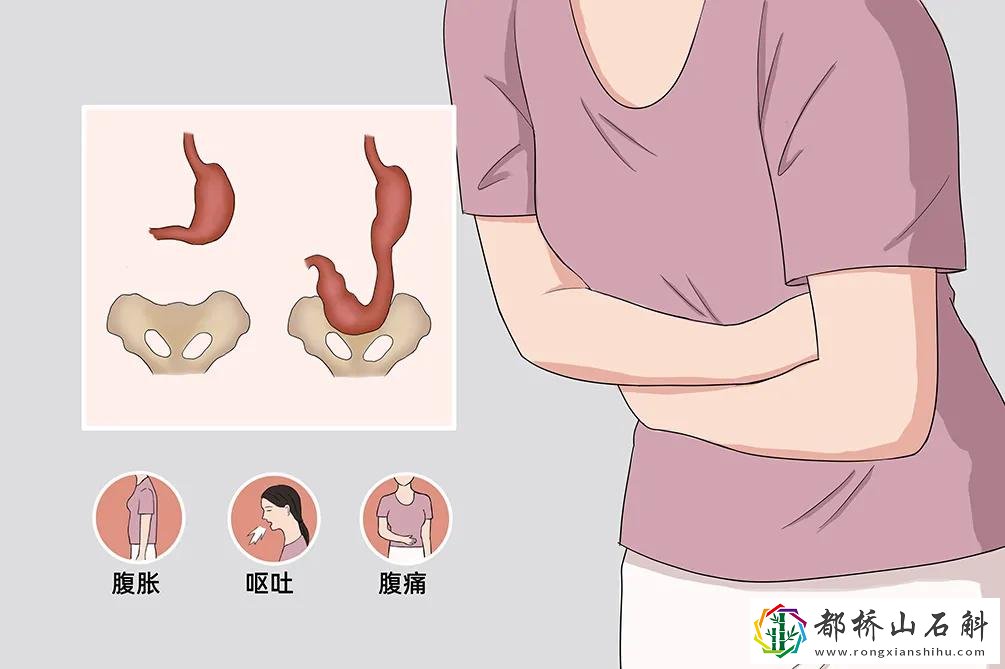 饭后剧烈运动的危害【饭后剧烈运动会引起不良后果】