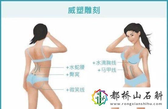 吸脂减肥都有哪些误区