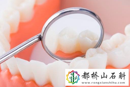 怎么判断是不是智齿【长智齿是因为上火吗】