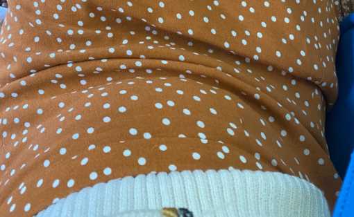 小肚子变大是妇科病吗1