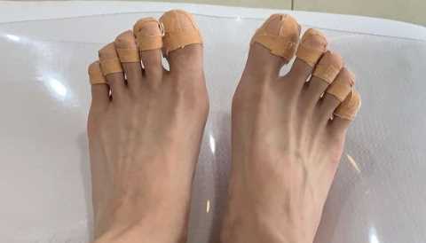 亮甲能治好灰指甲吗3