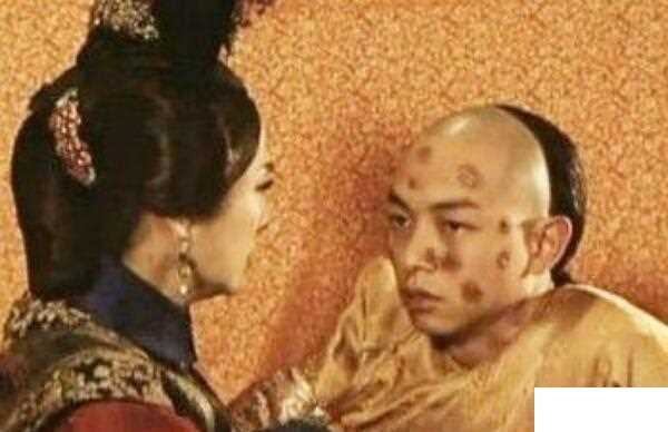 得花柳病的同治